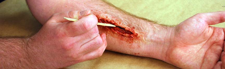 Introducing The Skin Tite™ Ultimate Wound Kit