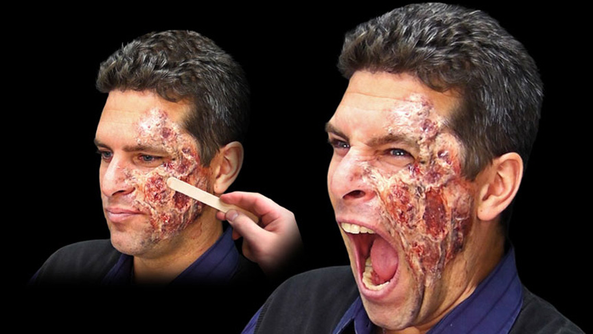 Skin Tite™ Silicone Adhesive & On-Skin Appliance Builder Introduced